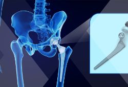 3D Printing in Healthcare Makes It Personal