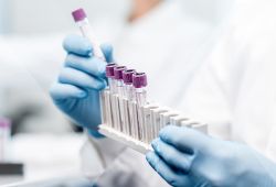 Companion Diagnostics Key to Individualized Healthcare