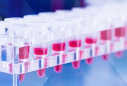 What is Liquid Biopsy? Precision Medicine's Tool of the Future.